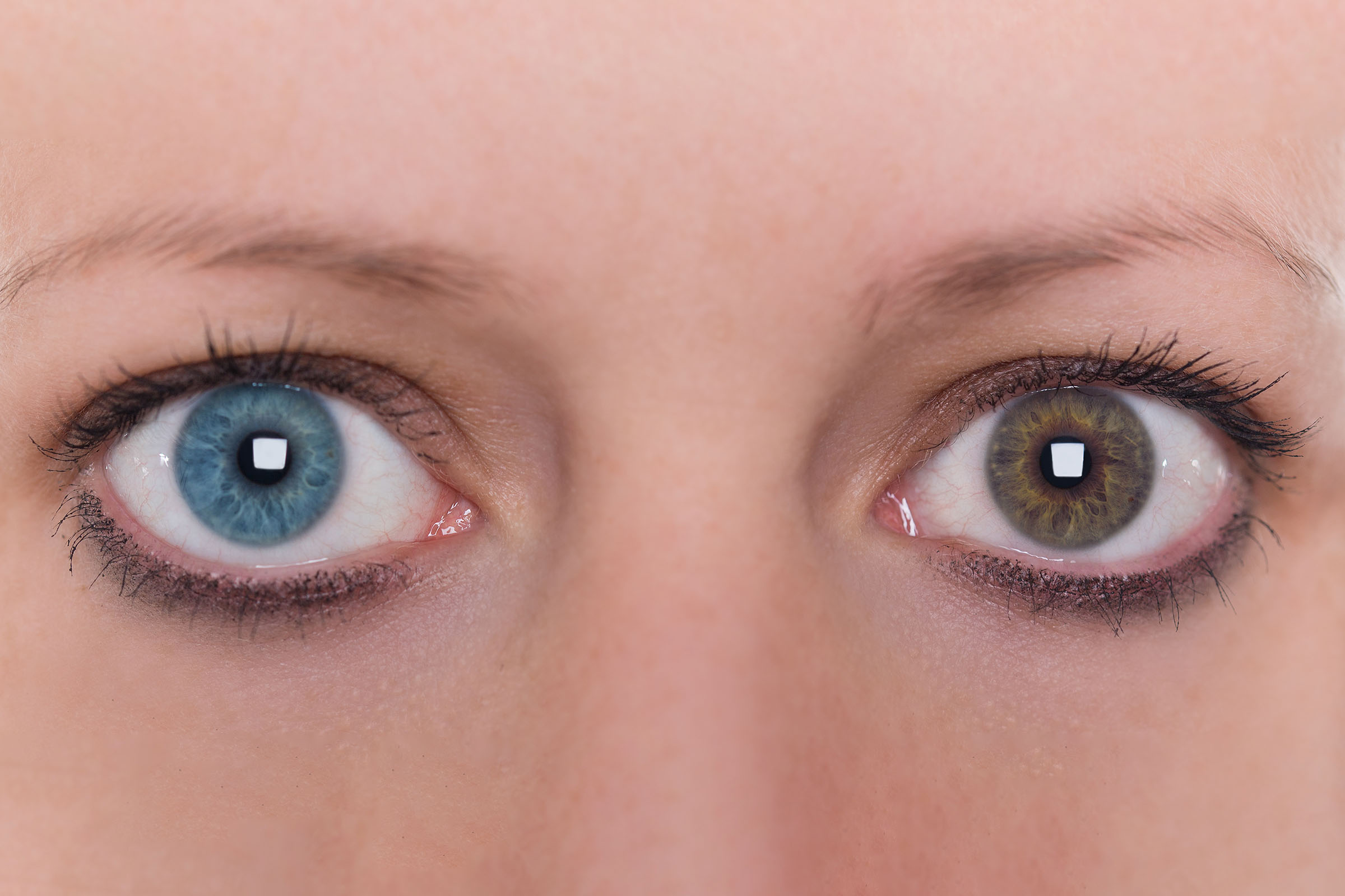Unterschiedliche Augenfarben Wie Heterochromien entstehen Dynoptic
