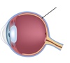 Coroide - La salute degli occhi - Dynoptic è il marchio di qualità per occhiali e lenti: shop e consulenza personalizzata presso 100 dynoptic. Consiglio ora!