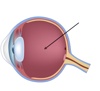 Corpo vitreo - La salute degli occhi - Dynoptic è il marchio di qualità per occhiali e lenti: shop e consulenza personalizzata presso 100 dynoptic. Consiglio ora!