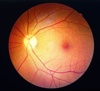 L'examen du fond de l’œil - Dynoptic est le label de qualité des opticiens suisses. Nos partenaires se réjouissent de votre visite. Obtenir des conseils!