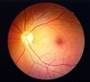 Fundus - Dynoptic ist das Qualitätslabel der führenden Schweizer Optiker. Über 100 Partner freuen sich auf Ihren Besuch. Jetzt beraten lassen!