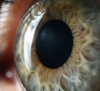 Il colore degli occhi - Dynoptic è il marchio di qualità per occhiali e lenti: shop e consulenza personalizzata presso 100 dynoptic. Consiglio ora!